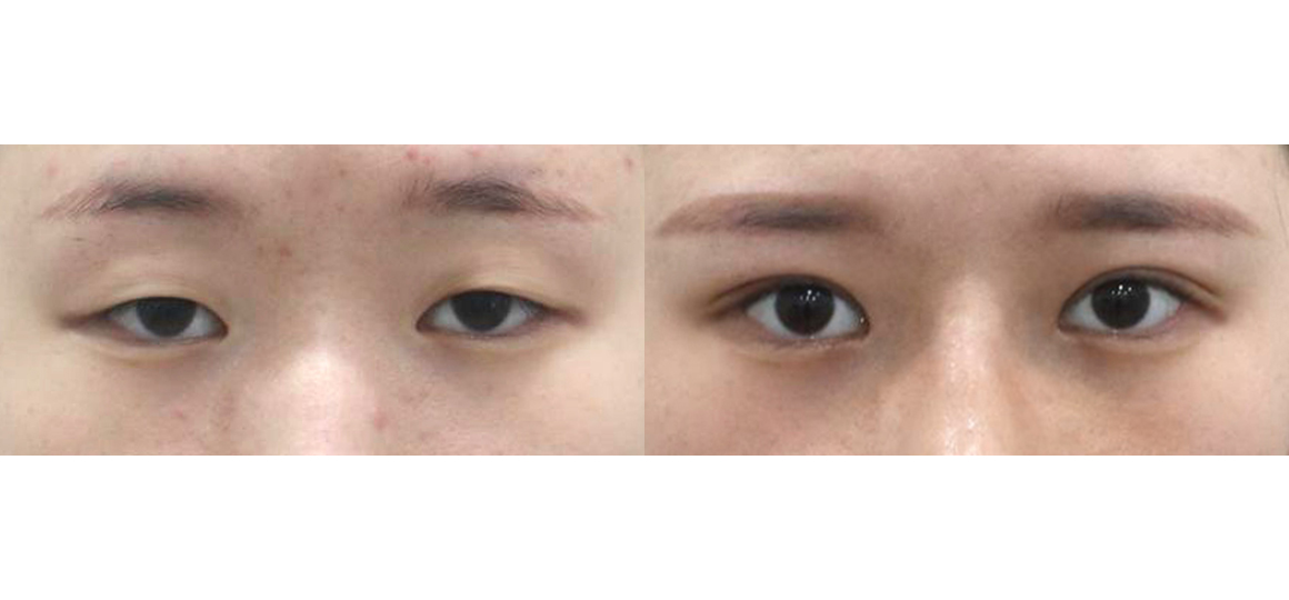 눈55