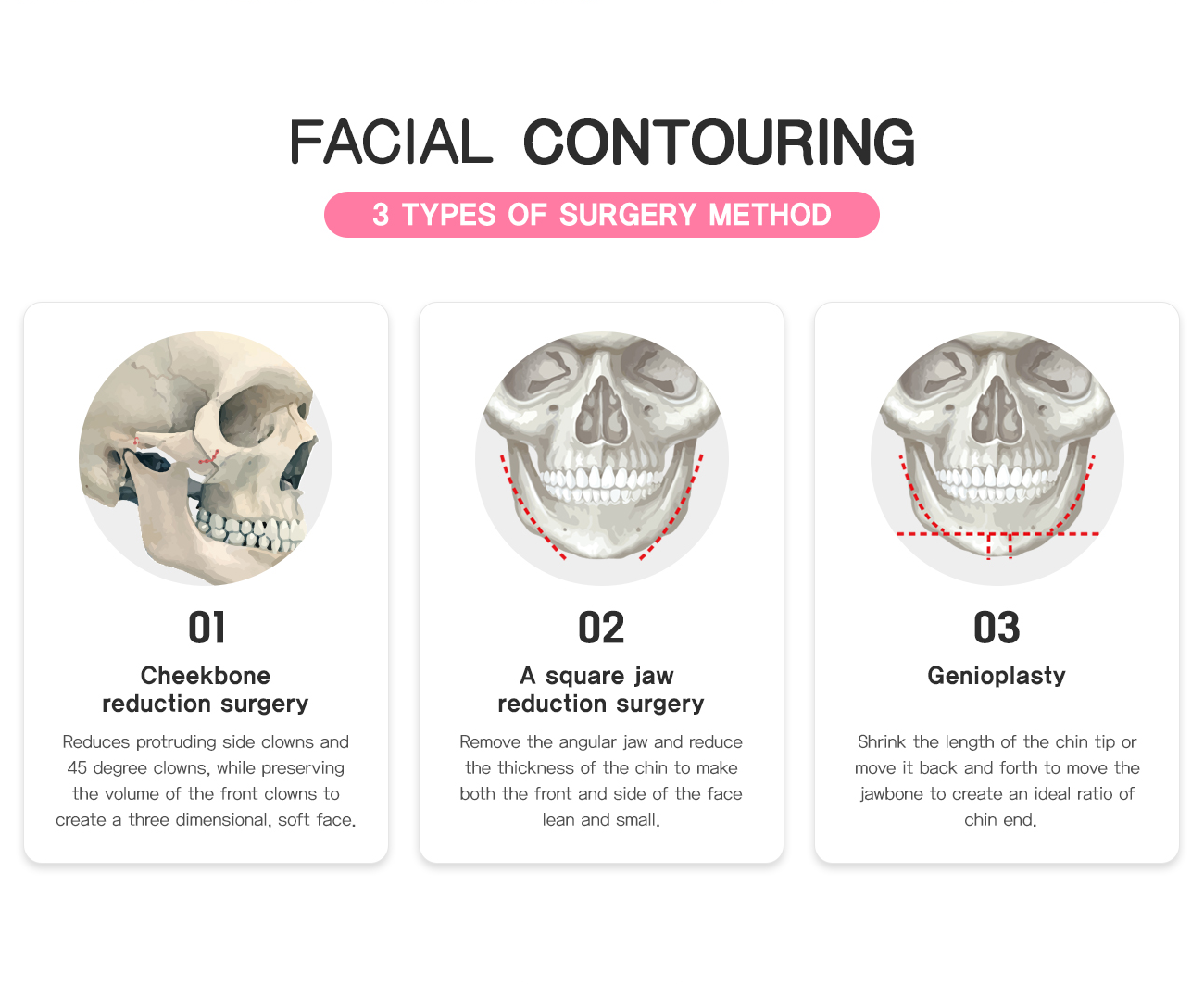 Facial contouring