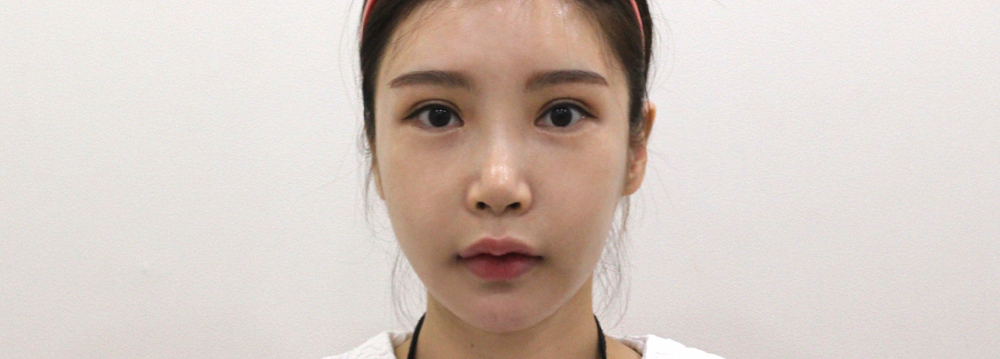 After