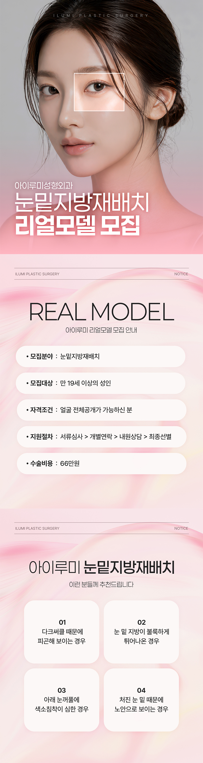 눈밑지방재배치