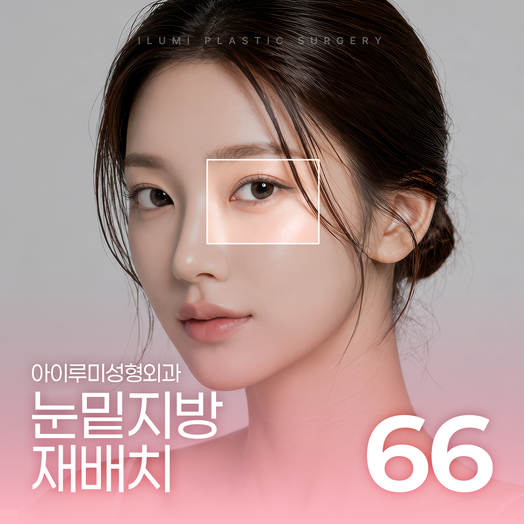 눈밑지방재배치